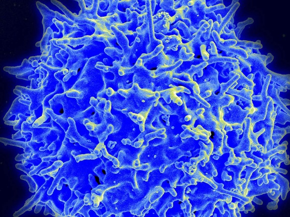 Study Uncovers Possible Path for Improving T Cell Therapies